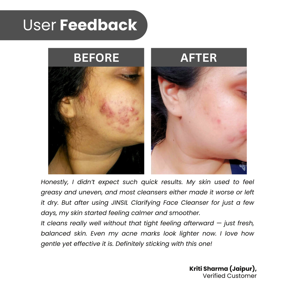 Clarifying Face Cleanser